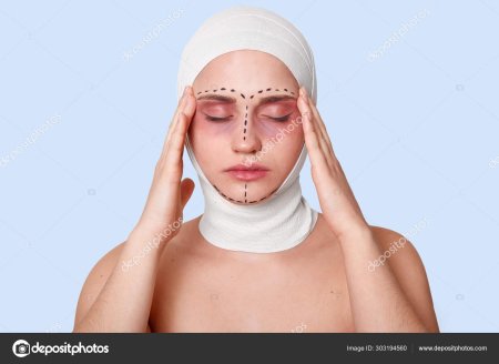Пластическая хирургия
