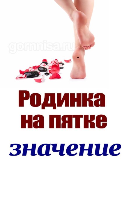 Родинка на пятке значение