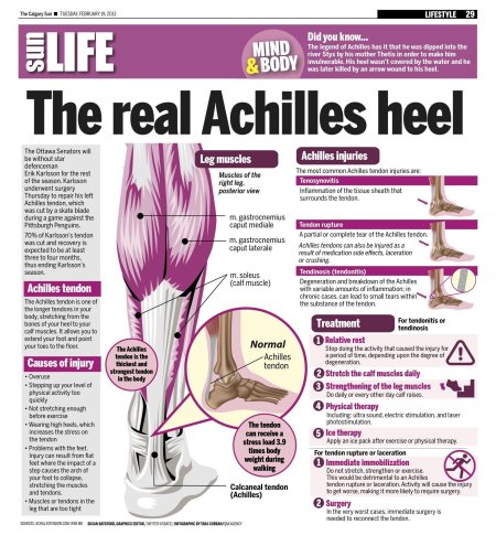 Achilles tendon rupture