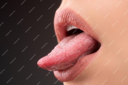Слизистая языка
