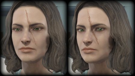 Fallout 4 глаза синта