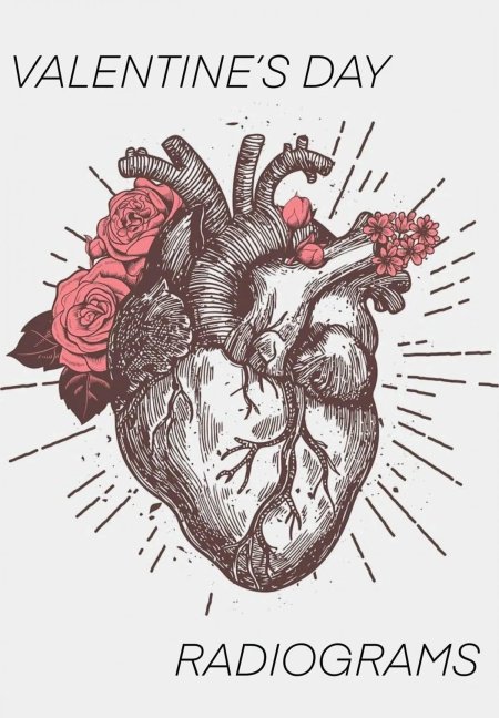 Рисунок сердца анатомия