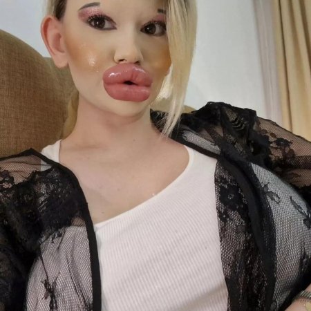 Женщина с самыми большими губами